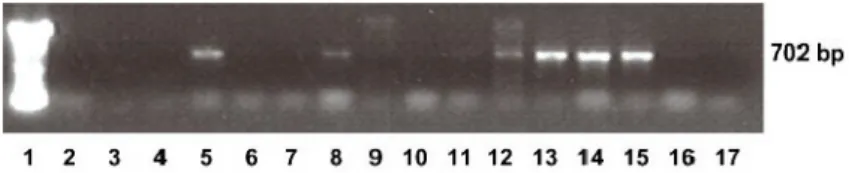Figure 2. Detection of negative stranded RNA of DWV. Negative stranded RNA of DWV was detected in six (lanes 5, 8, 12-15) out of 15 SHB that were fed on infected honeybee workers and previously identiﬁed as being DWV positive by RT-PCR assay (lane 1: 100-b