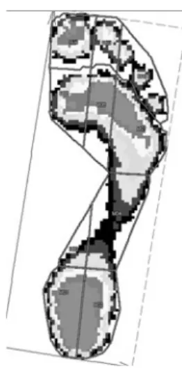 Fig. 4 The PRC mask for pedo- pedo-barographic evaluation divides the foot into lateral and medial heel, lateral and medial midfoot, and forefoot consisting of first, second, and lateral metatarsal head, hallux, second toe, and lateral toes.