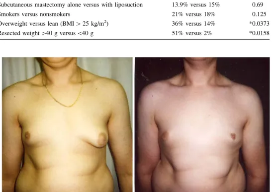Fig. 3 Left: 23-year-old patient with idiopathic, unilateral gynecomastia (stage IIb)