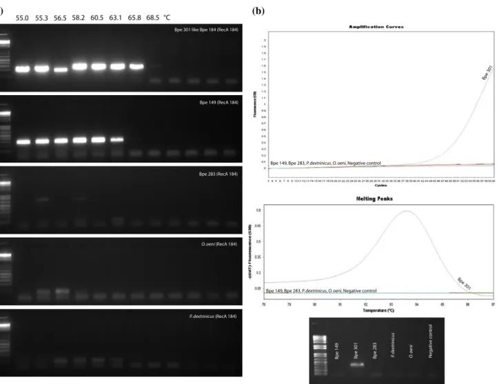 Fig. 4 Reaction of strains Bpe 301, Bpe 149, Bpe 283, P. dextrinicus and Oenococcus oeni to the PCR primer pairs 184-F and  R