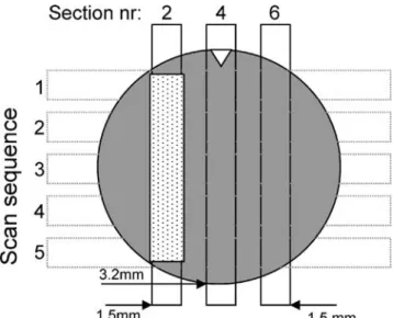 Fig. 3 Comparison of TMR and QLF. Of each disc section (labeled 2, 4, 6) prepared for TMR, five equidistant scans (labeled 1 through 5) were made