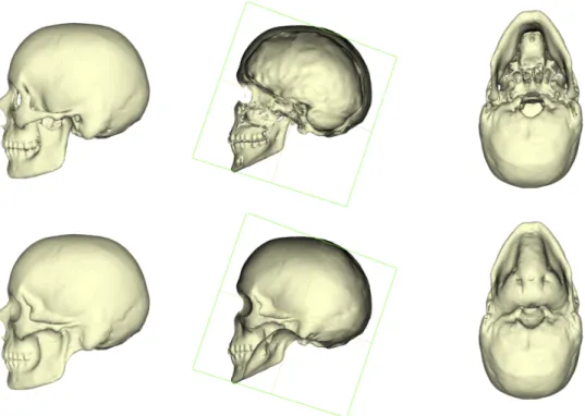Figure 7 – Top: 3d model of the skull. Bottom: wrapped skull.