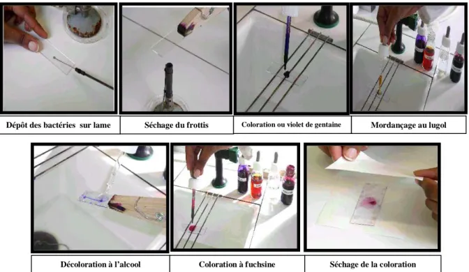 Figure 8.  Les étapes de la Coloration de Gram. 