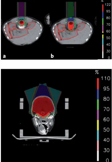 Figure 4. Dose distribution with spot-scanning proton therapy for the  posterior fossa volume (axial CT; thin green line: planning target  vol-ume)
