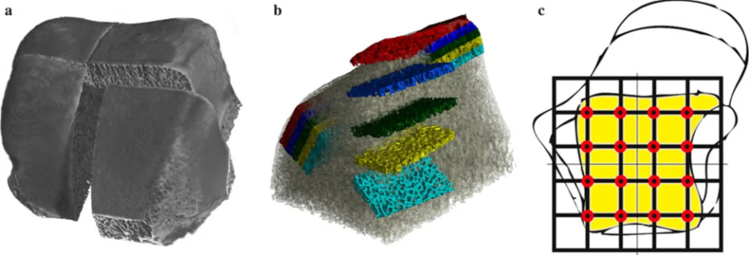 Fig. 2 Gray value histogram of a quartered talar specimen. Maximum 1 air, Maximum 2 container, Maximum 3 mineralized bone