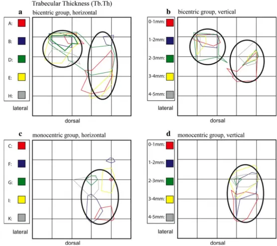 Fig. 9 Summation schemes for the numerical parameter Trabecular thickness (Tb.Th).