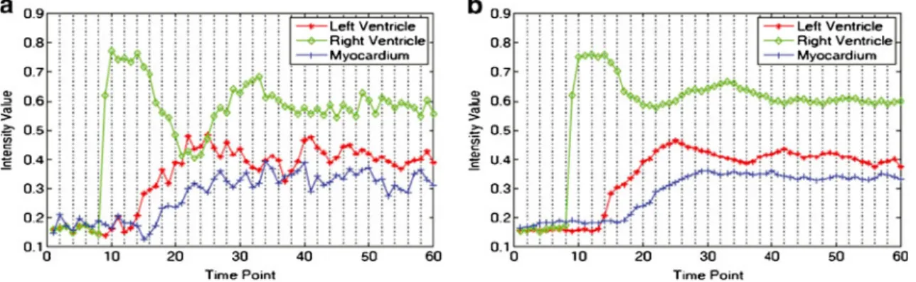 Fig. 3 Intensity change with time for pixels on epicardium, RV, and endocardium; a before groupwise registration; b after groupwise registration