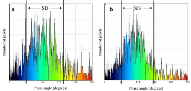 Fig. 1 Effect of CRT on intra-ventricular resynchronisation: phase histograms of the left ventricle illustrating dispersion of phase angles during ventricular ejection, plotted as phase angle (x-axis) versus number of pixels (y-axis)
