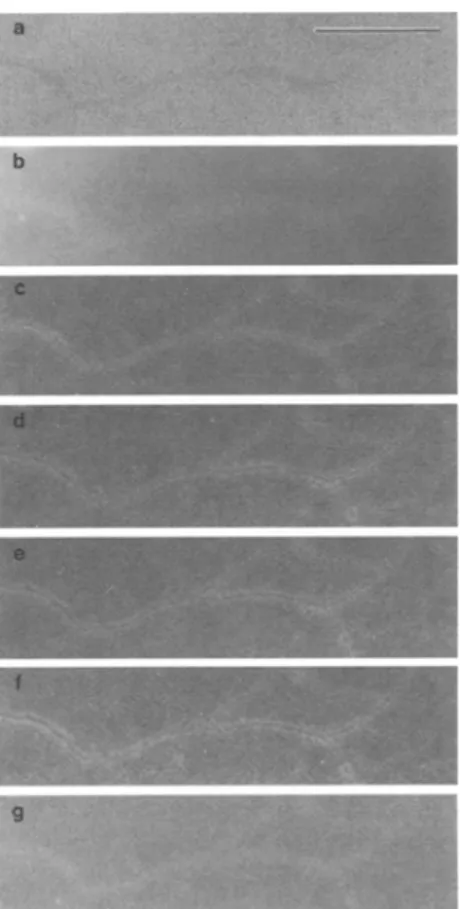 Fig. 3.  Assembling of bright field TEM (a) and CT-TEM (b g) of  a network of xanthan (uranyl acetate 0.05%  en bloc),  b 50 eV, e 140  eV, d 200 eV, e 250 eV, f 270 eV, g 300 eV