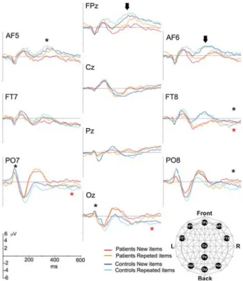 Figure 2 displays the results of the waveform analysis performed on 10 electrode positions during three time intervals