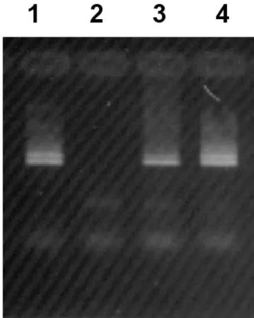 Figure 2. Pathological finding at autopsy: specimen of the myocar- myocar-dium stained with periodic acid Schiff (PAS) and the specific diastase  PAS (inset)