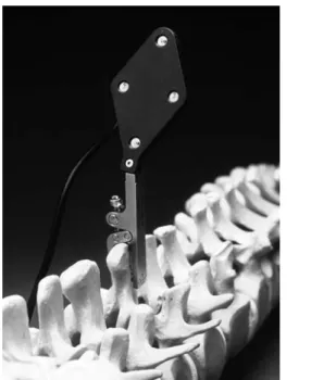 Figure 7. Dynamic reference base (DRB). A DRB allows a navigation system to track the anatomic structure on which the surgeon is  oper-ating