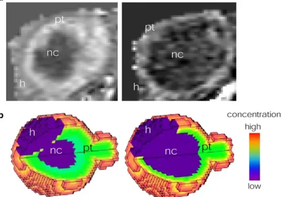 Fig. 5 DCE-MRI (a) and simulation results (b) for uptake of low molecular weight (left) and macromolecular contrast agent (right) in subcutaneously implanted mammary tumor in nude mice