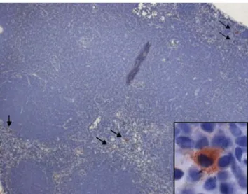 Fig. 1 Lymph-node-resident melanocytes. A skin-draining lymph node was immunostained with the polyclonal anti-tyrosinase pep7 antiserum [50]