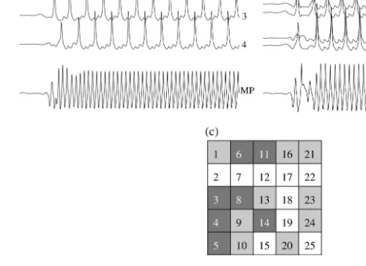 Fig. 6. Numerical simulations of several identical cells electrically coupled to their first neighbors in the