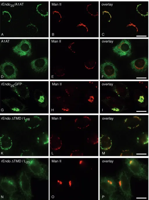 Figure 3. Endomannosidase sig- sig-nal sequence is sufficient for Golgi localization of  a1-antitryp-sin and GFP