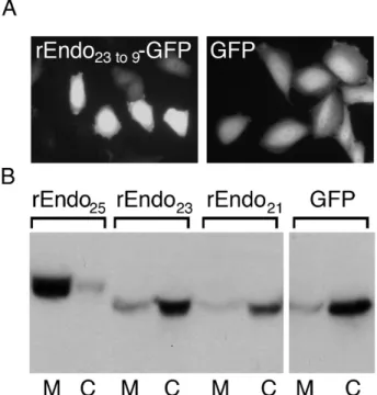 Figure 5. Rat endomannosidase-GFP constructs with a shortened signal sequence showed cytoplasmic localization