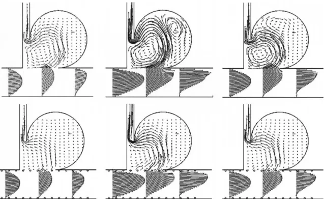 Fig. 3. Flow pattern of before and after stent. The flow speed in the aneurysm was reduced after stent placement.