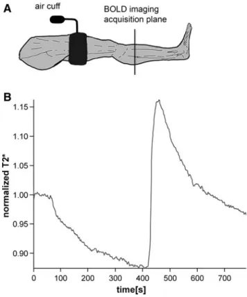 Fig. 1 a Experimental setup of the widely used cuff compression paradigm in skeletal muscle blood-oxygenation-level-dependent (BOLD) magnetic resonance imaging (MRI)