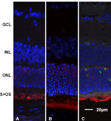 Fig. 7 Staining for caspase-6 (green) with DAPI nuclei staining (blue). Staining for caspase-6 was positive in control sections and after 30 mg/kg MNU treatment in the outer retina