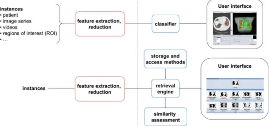 Fig. 1 Flowchart showing the similarities and differences between detection-based CAD (top) and CBIR-based CAD (bottom)