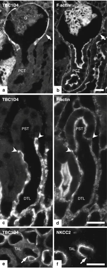 Fig. 3 Distribution of TBC1D4 in glomeruli and thin limbs. a–d Cryosections stained with a polyclonal antibody against TBC1D4 and phalloidin-FITC for detection of f-actin