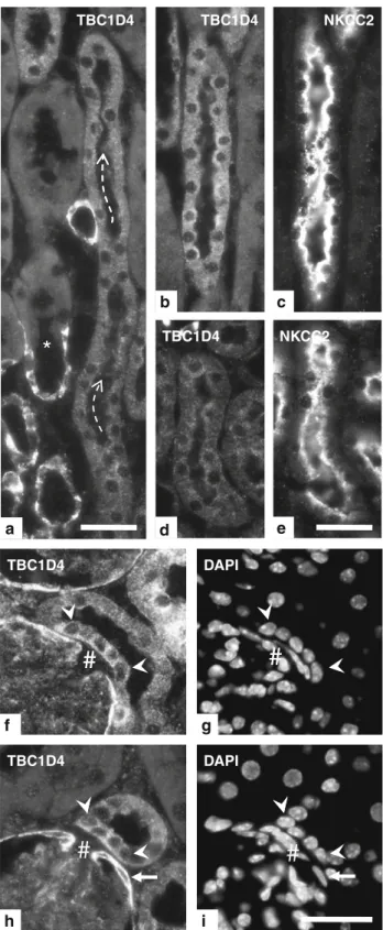 Fig. 4 TBC1D4 abundance along the thick ascending limb (TAL).