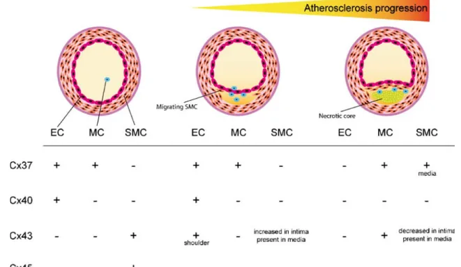 Fig. 3 Evolution of connexin expression during atherosclerosis progression. Atherosclerosis is a progressive vascular pathology implicating endothelial cells ( ECs ), monocytes/macrophages ( MCs ), and smooth muscle cells ( SMCs )