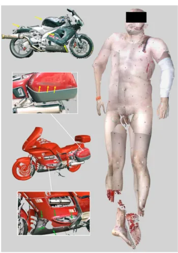 Fig. 9 Photographs of the green motorcycle of the deceased and the red motorcycle of the surviving driver as well as a 3D surface scan documentation of the victim
