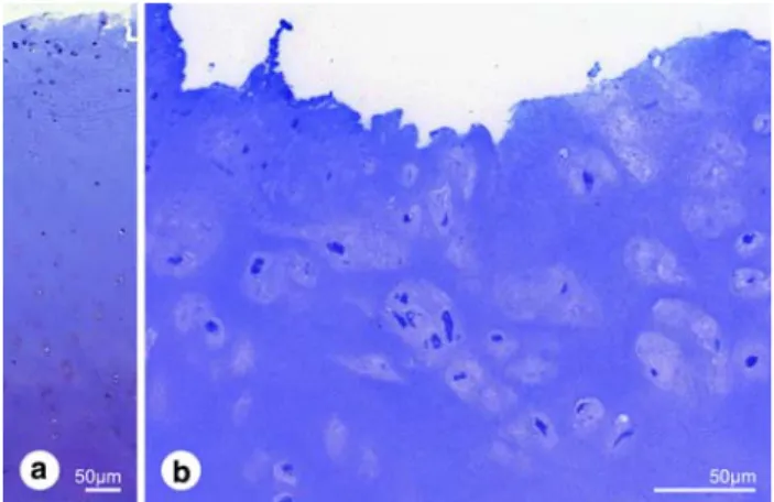 Fig. 2 Light micrographs of Richardson-stained semithin sections of degenerative cartilage