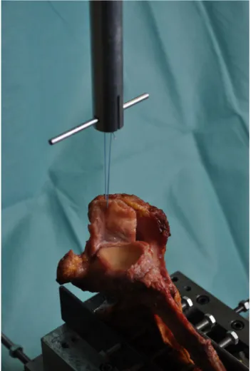 Fig. 1 Biomechanical test setting: The prepared scapula was set into a fixation device