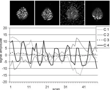Table 4 Mean speed-up factors for the real fMRI dataset