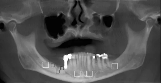 Fig. 1 Panoramic scout view of the CBCT unit showing an exemplary distribution of the ROIs