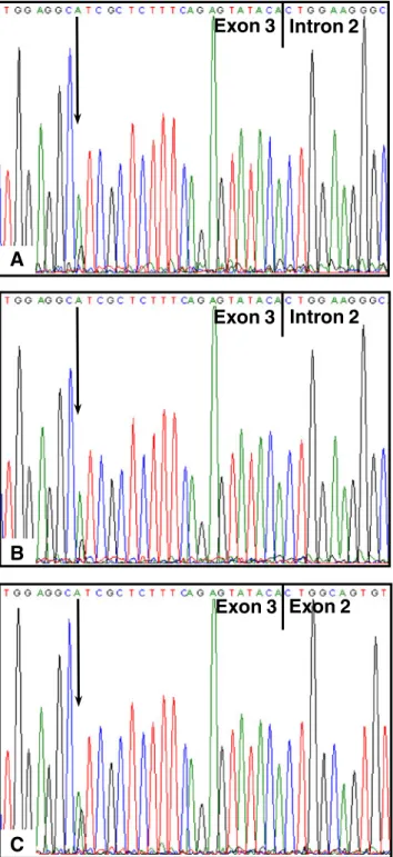 Fig. 5 VHL mutation c.484T&gt;C/p.Cys162Arg in the original DNA of one ccRCC patient (a), after WGA (b), and after WTA (c)