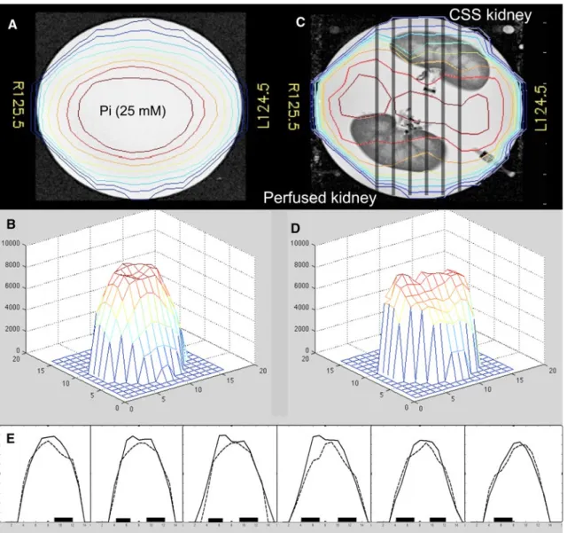 Fig. 7 31 P sensitivity profile of the coil. a, b Represent the isocontour and mesh plots of the empty perfusor, c, d represent the profile with 2 kidneys in the perfusor (one under simple cold storage (CSS), and the other under oxygenated HPP)