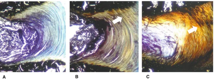 Fig. 5 Effect of BMP-2 and TGF-b3 on disc histology. Disc specimens were embedded into PMMA and histological section were stained with von Kossa (bone specific, black stain) and toluidine blue (GAG specific, blue stain)