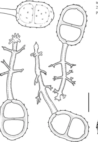 Fig. 2 Prospodium bicristatum. Teliospores with appendaged ped-