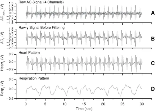 Figure 4. Example of a 30-sec SSG recording at different processing steps. (A) Raw AC signal  as recorded by four sensors, A, B, C, and D
