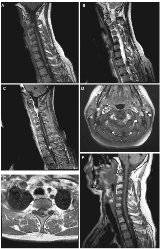 Fig. 1 Magnetic resonance imaging. Sagittal MRI of the cervical/