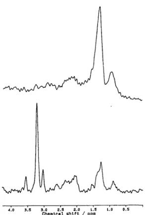 Fig.  2.  MR  spectra  of  two  different  glioblastomas  multi-  forme.  Both  spectra  were  correctly  assigned  as  high-  grade  glioma
