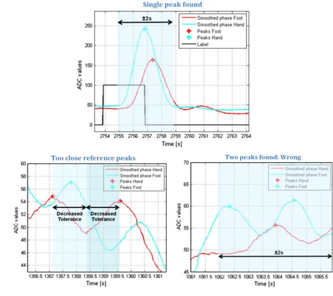 Fig. 6 Correlation of the level signals measured at the hand and at the foot during the first relaxation and the four movement conditions