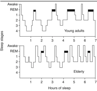 Figure 1 - Changes in sleep architecture associated with aging: 