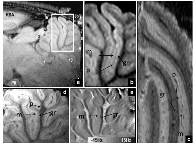 Figure 2 shows some of the main observations in a recent study where T 2 *
