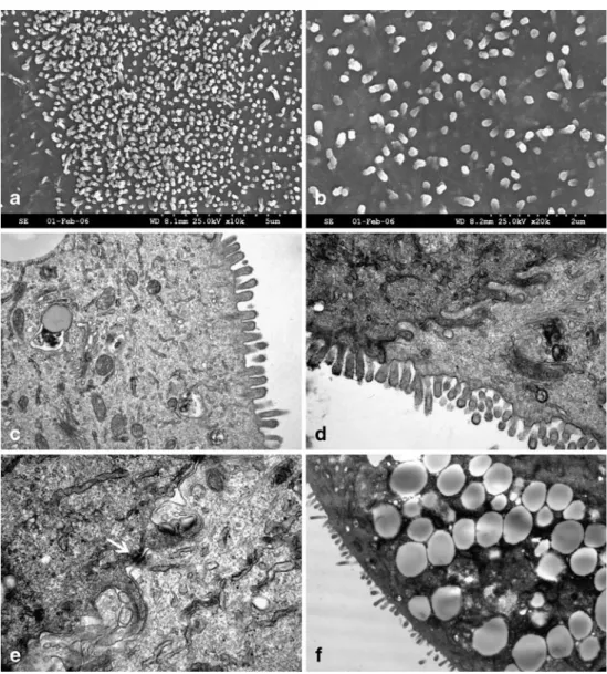 Figure 4 Characterization of the cell line with electron  mi-croscopy. Scanning electron micrographs (a – b) and  trans-mission electron micrographs (c–f ) from confluent monolayers of intestinal epithelial cells