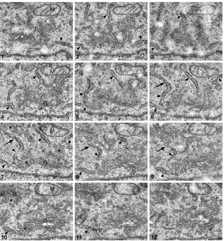 Fig. 1 Series of consecutive ultrathin sections from CHO Ins2 wt cells. The spatial relationship between transitional elements of the rough ER (arrowheads) and their budding profiles, Golgi-associated pre-Golgi intermediates (asterisks), and Golgi apparatu
