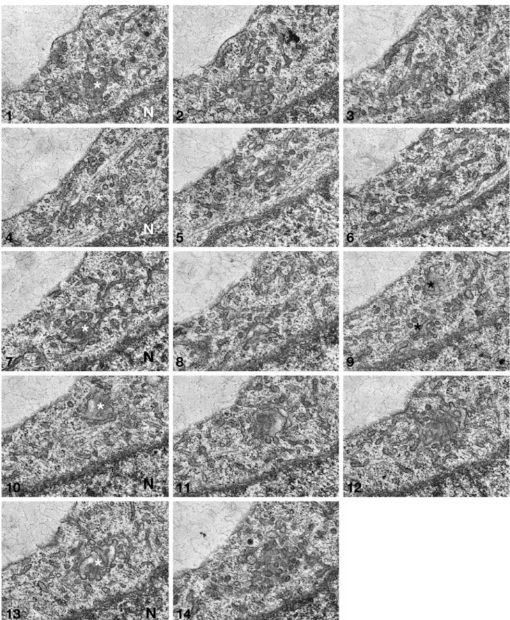 Fig. 4 Series of 14 consecutive ultrathin sections out of 24 serial sections from CHO Ins2 C96Y cells showing two peripheral pre-Golgi intermediates (asterisks)