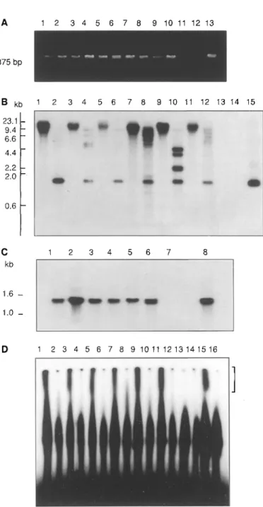 Fig.  1A-It  Transgenic  Lolium muhiflorum  plants from particle-in-  flow-gun-mediated  microprojectile  bombardment  of  embryogenic  suspension  cells