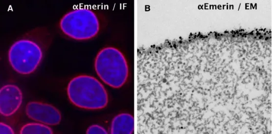 Figure 5 shows a number of micrographs of thin- thin-sectioned chromosomes immunostained for hBar or topoII α (indicated) using the UV-complete protocol (a – e)