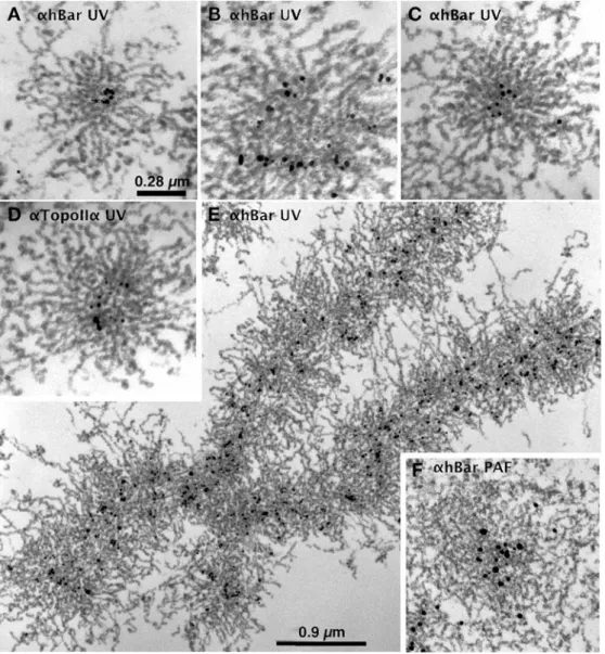 Fig. 5 Immuno-EM of chro- chro-mosomal scaffolding proteins in UV-irradiated chromosomes.