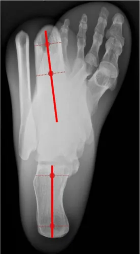Fig. 1 Long axial view radiograph (LAR) of human foot skeleton embedded in acrylic glass (phantom A)